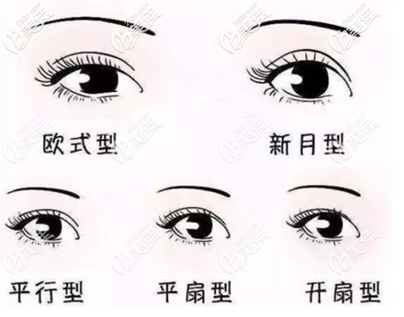 常見(jiàn)的雙眼皮形狀 常見(jiàn)的雙眼皮形狀