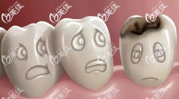 樹脂補(bǔ)門牙的弊端就是時間長了會容易變色