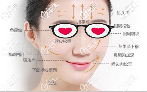 面部哪些部位適合做熱拉提 面部哪些部位適合做熱拉提