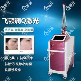 飛頓調(diào)Q激光儀器
