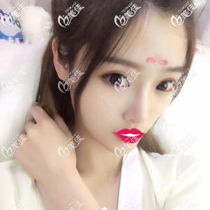 在泰國(guó)做除皺術(shù)后1個(gè)月面部皮膚衰老癥狀消除 在泰國(guó)做除皺術(shù)后1個(gè)月面部皮膚衰老癥狀消除