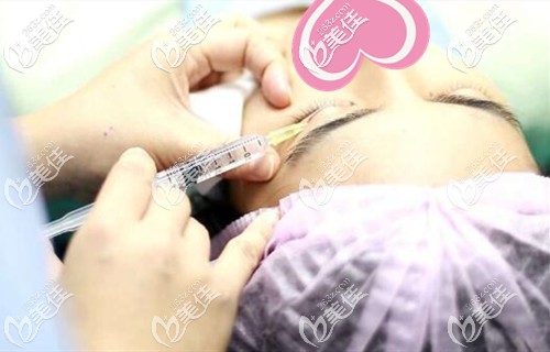 雙眼皮手術(shù)注射麻藥 雙眼皮手術(shù)注射麻藥