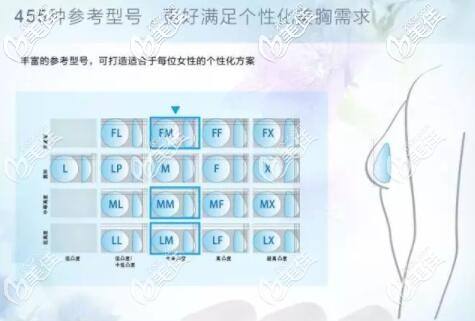 娜綺麗隆胸假體的多種型號介紹 娜綺麗隆胸假體的多種型號介紹