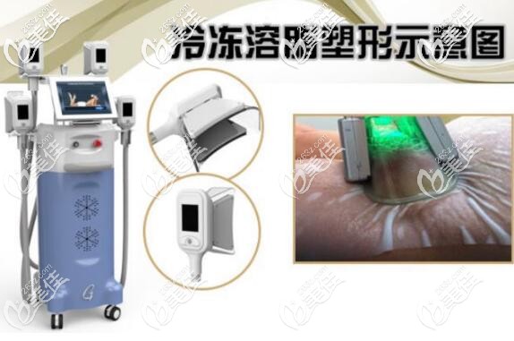 酷塑冷凍溶脂示意圖 酷塑冷凍溶脂示意圖