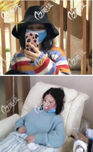 做完鼻子三天了 做完鼻子三天了