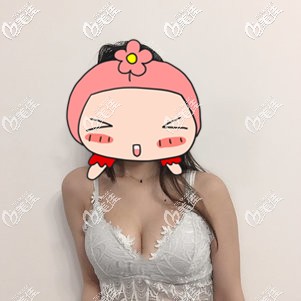 網(wǎng)友不建議做自體脂肪隆胸是因?yàn)樾g(shù)后成活率低，但自己又怕假體明顯所以選擇做了復(fù)合隆胸