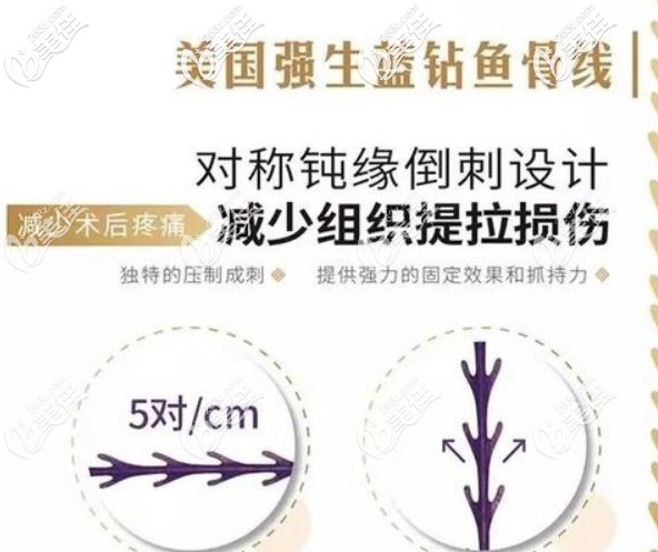 美國強(qiáng)生藍(lán)鉆魚骨線優(yōu)勢(shì)