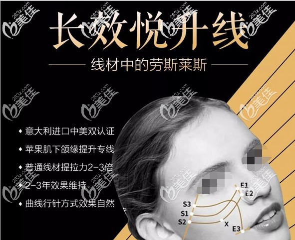 意大利悅升線優(yōu)勢(shì)