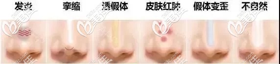 隆鼻失敗常見癥狀