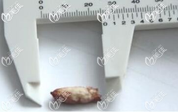 取出的骨粉圖片 取出的骨粉圖片