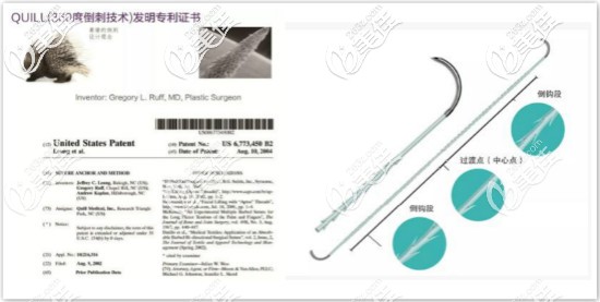 美國(guó)進(jìn)口快翎線介紹