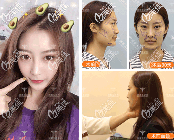 北京潤(rùn)美玉之光王明利