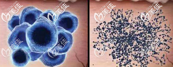 皮秒作用的原理