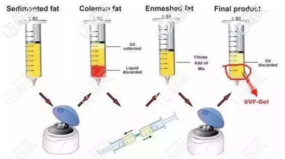 脂肪膠提取過程 脂肪膠提取過程
