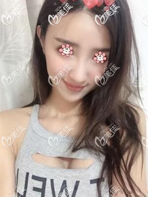 這醫(yī)院在泰國隆胸還真可以 這醫(yī)院在泰國隆胸還真可以