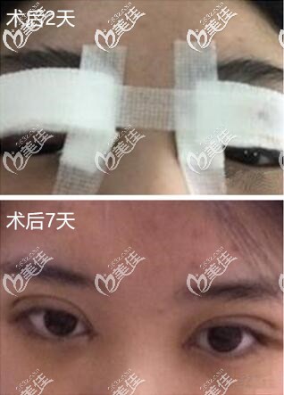 剛手術(shù)完樣子