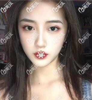 兩個月已經(jīng)超好看了