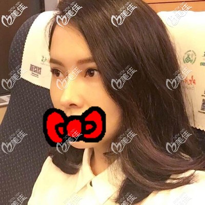 術(shù)后一周手術(shù)部位還有點腫 術(shù)后一周手術(shù)部位還有點腫