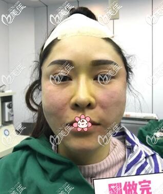 楊任歡醫(yī)生剛給我手術(shù)完