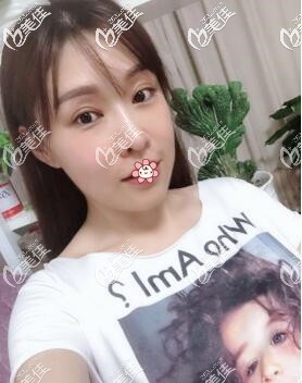 重慶哪個(gè)醫(yī)院做面部埋線提升手術(shù)好