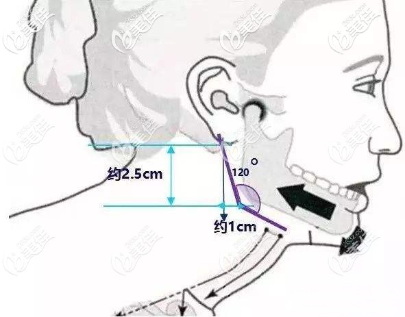 下頜角美學(xué)標(biāo)準(zhǔn) 下頜角美學(xué)標(biāo)準(zhǔn)