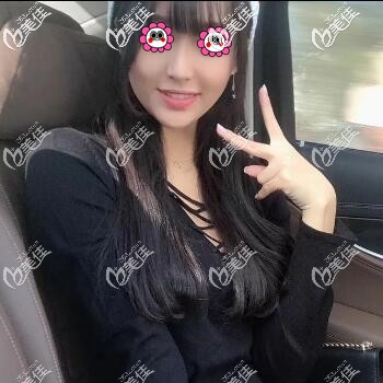 做面部埋線提升術后一個月后想恢復<span style=