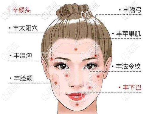 面部脂肪填充的部位 面部脂肪填充的部位