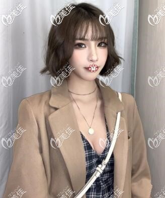 泰國Yanhee曼托假體隆胸術(shù)后2個月 泰國Yanhee曼托假體隆胸術(shù)后2個月