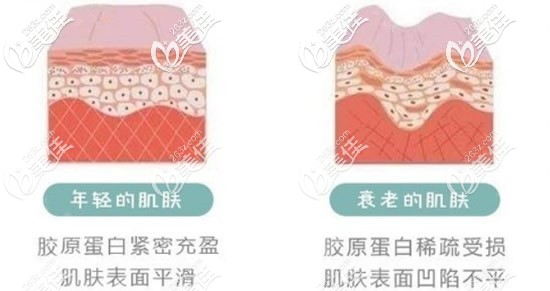 年輕肌膚和衰老肌膚對(duì)比
