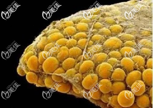 包裹脂肪細(xì)胞的纖維組織