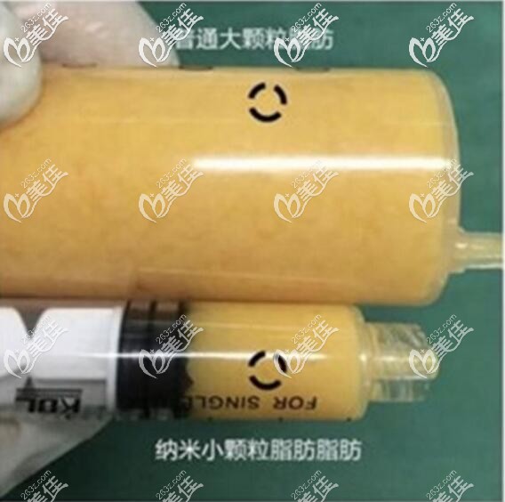 普通脂肪和脂肪膠的區(qū)別