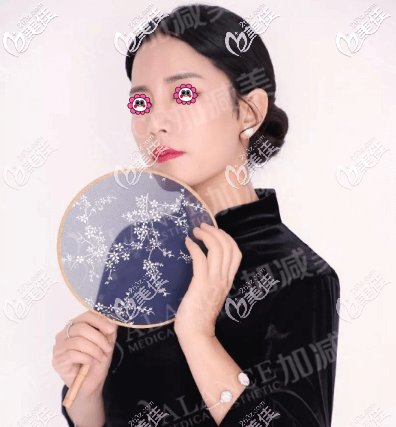 我做V美減齡術(shù)100天樣子