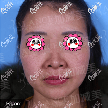 我做手術(shù)前舊照 我做手術(shù)前舊照