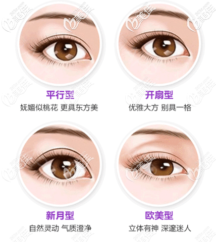 各種雙眼皮類型圖片 各種雙眼皮類型圖片