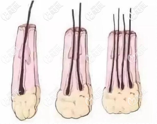 提取毛囊組織的形態(tài) 提取毛囊組織的形態(tài)