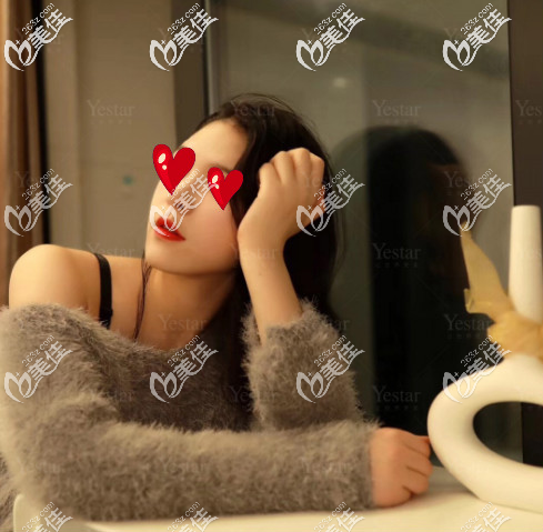 濟(jì)南藝星面部脂肪填充后20天