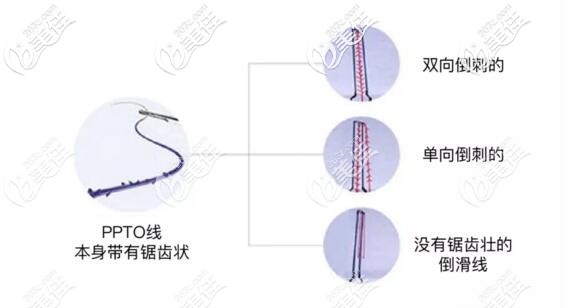 蛋白線的不同種類