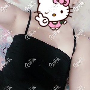 隆胸手術(shù)前自己的平胸 隆胸手術(shù)前自己的平胸