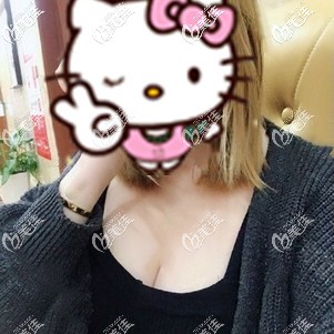 假體隆胸術(shù)后24天腫脹漸消 假體隆胸術(shù)后24天腫脹漸消