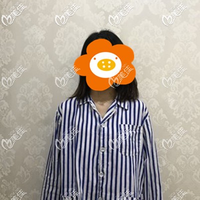 做隆胸手術(shù)前我的小A胸 做隆胸手術(shù)前我的小A胸