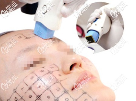 熱瑪吉的操作原理 熱瑪吉的操作原理