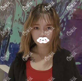 得知長沙臉博士是正規(guī)整形機(jī)構(gòu)后我找唐永豐做了雙眼皮效果還真是不錯??！