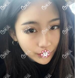 兩個(gè)月以后