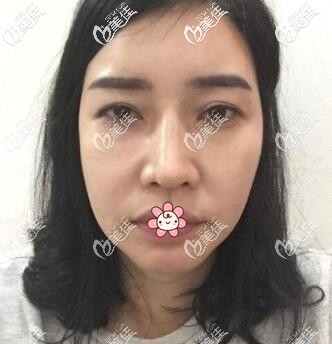 我的臉?biāo)沙谙麓? alt=