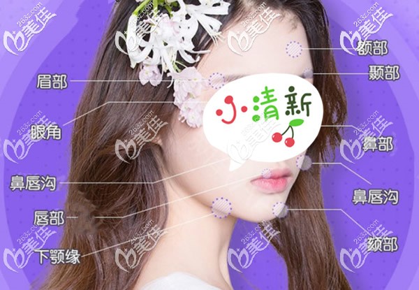 玻尿酸填充全臉的部位 玻尿酸填充全臉的部位