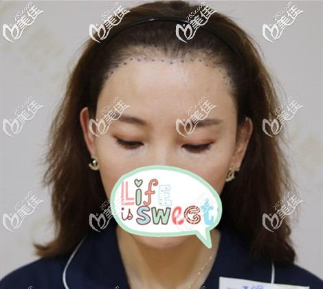 根據(jù)臉型設(shè)計(jì)的發(fā)際線