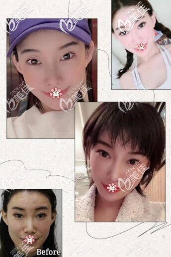 重慶杜航航案例