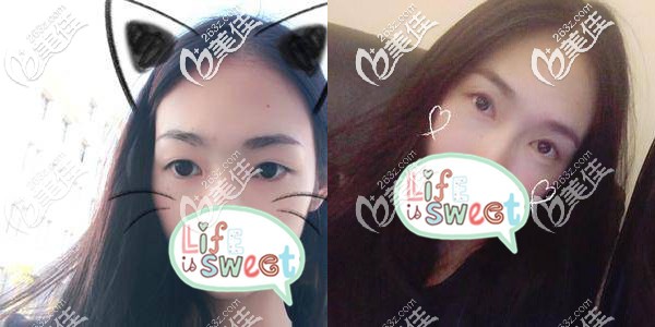 之前的眼睛雖然大，但是不夠有魅力