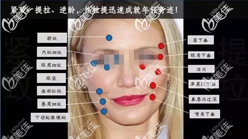 熱拉提的作用效果