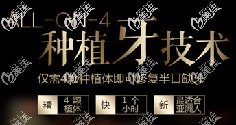 北京牙管家all-on4種植技術(shù) 北京牙管家all-on4種植技術(shù)